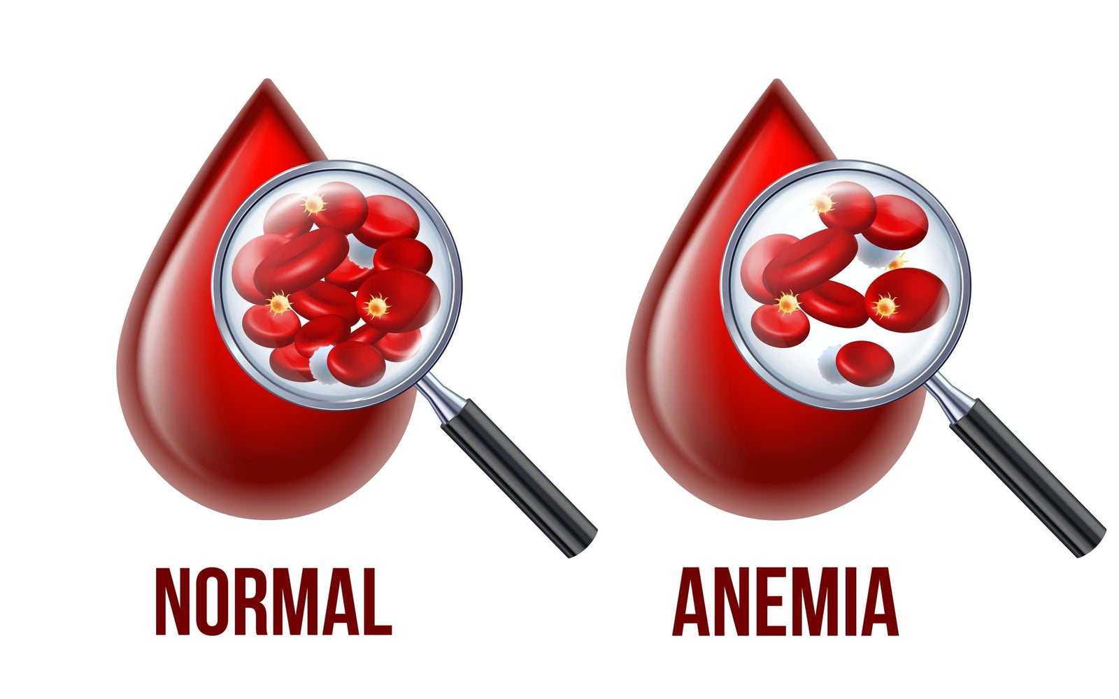 How Can I Tell if I’m Anaemic?