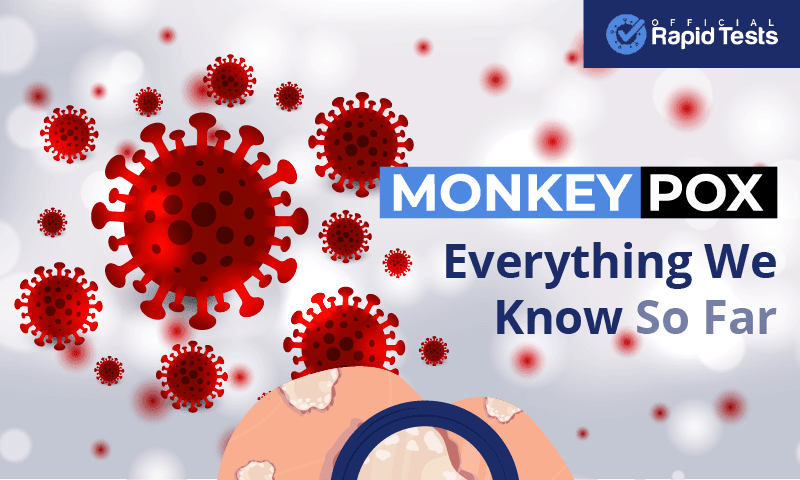 Monkeypox: Everything We Know So Far - Official Rapid Tests