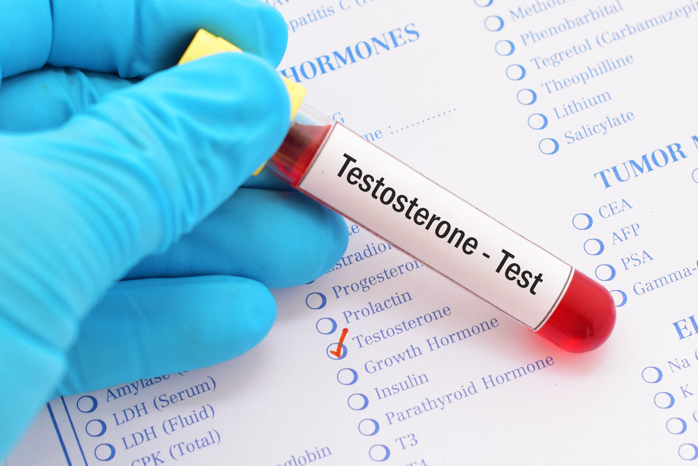 How to Check Testosterone Levels at Home in the UK